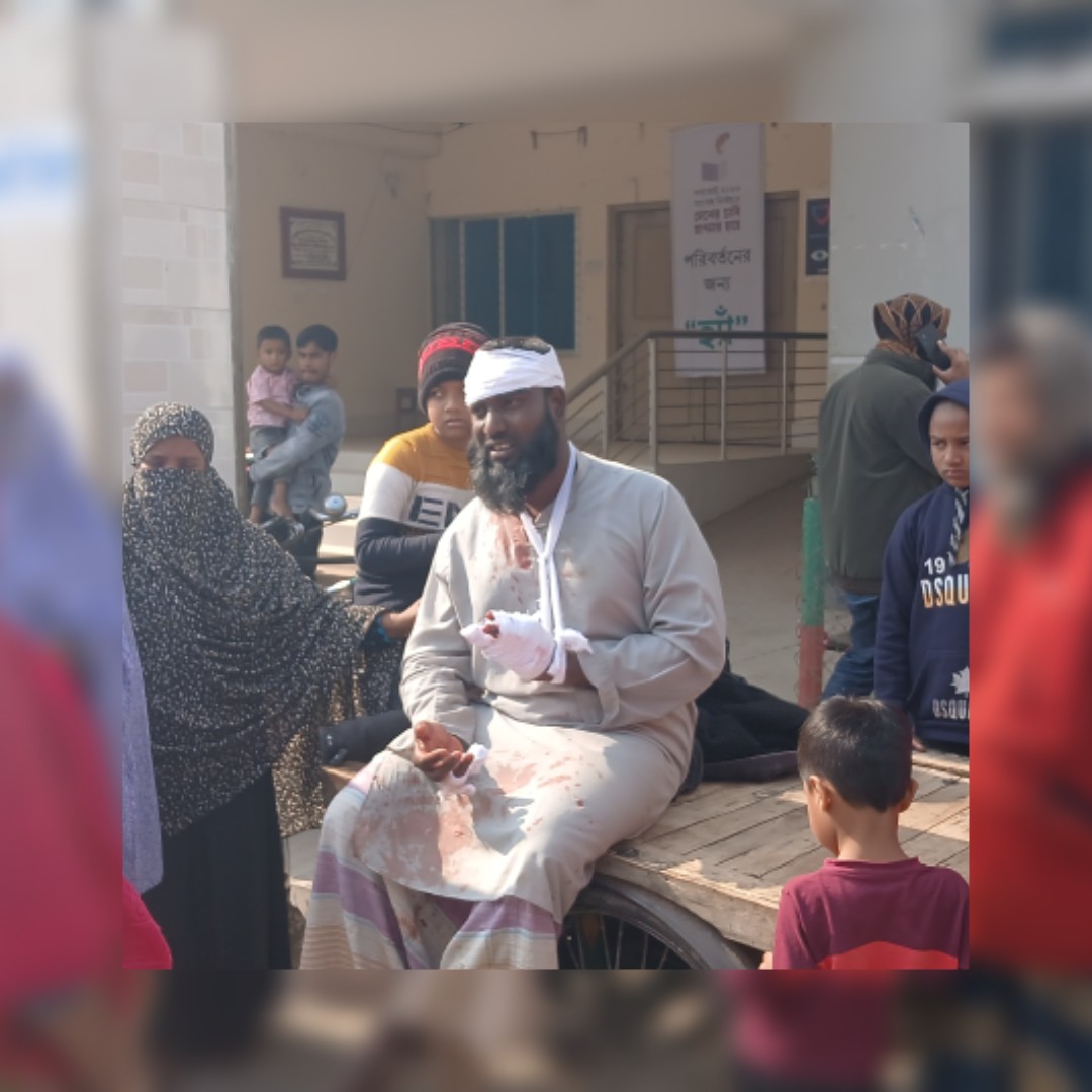 আলমডাঙ্গায় নির্বাচনী সহিংসতা: জামায়াত কর্মী মিনারুলের হাতের রগ ও আঙুলের নার্ভ কর্তন