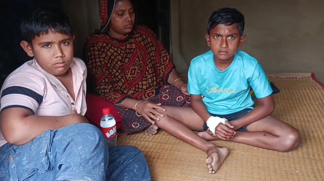 চুয়াডাঙ্গার আলমডাঙ্গায় খেলার ছলে পটকা বিস্ফোরণ: ৩ শিশু গুরুতর আহত, একজনের ৫ আঙুল বিচ্ছিন্ন