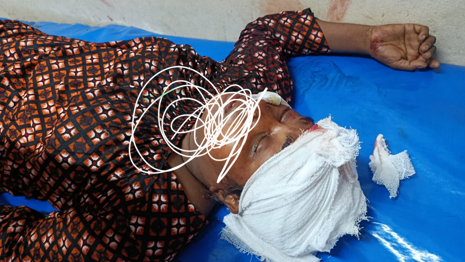 আলমডাঙ্গায় আত্মহত‌্যা করতে গিয়ে ট্রেনের ধাক্কায় গৃহবধূ গুরুতর আহত